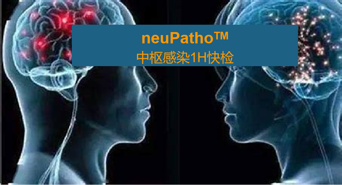 neuPatho，中樞感染病原譜